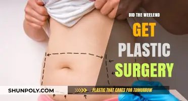 Did Weekend Undergo Plastic Surgery? Unraveling the Transformation Rumors