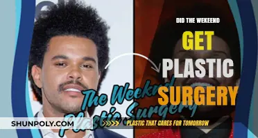 Did The Weeknd Undergo Plastic Surgery? Unraveling the Transformation Rumors