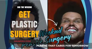 Did The Weeknd Undergo Plastic Surgery? Analyzing the Transformation
