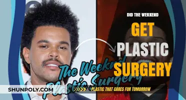 Did The Weeknd Undergo Plastic Surgery? Unveiling the Truth Behind His Look
