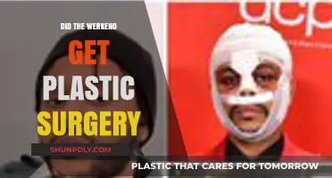 Did Werkend Undergo Plastic Surgery? Unraveling the Transformation Rumors
