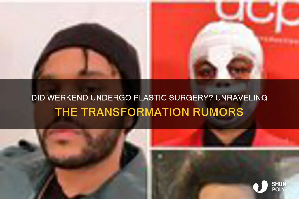 did the werkend get plastic surgery