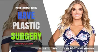 Did the Wirkus Twins Undergo Plastic Surgery? Unveiling the Truth