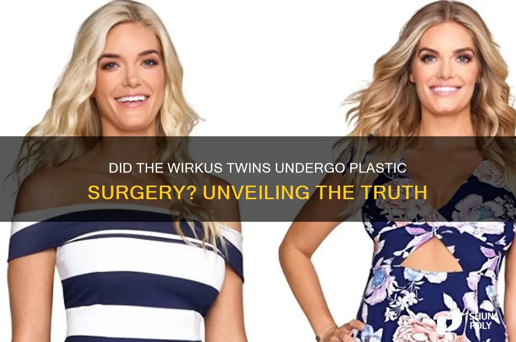 did the wirkus twins have plastic surgery