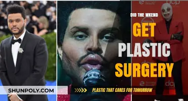 The Weeknd's Transformation: Uncovering Plastic Surgery Speculations and Truths