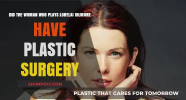 Did Lorelai Gilmore's Actress Lauren Graham Get Plastic Surgery?