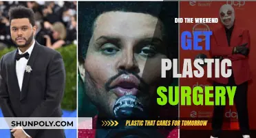 Did The Weeknd Undergo Plastic Surgery? Unraveling the Transformation Speculations