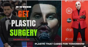 Did The Weeknd Undergo Plastic Surgery? Unveiling the Truth Behind His Look