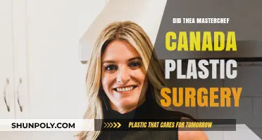 Thea MasterChef Canada Plastic Surgery Rumors: Fact or Fiction?