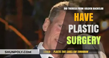 Did Theresa Golden Bachelor Undergo Plastic Surgery? Unveiling the Truth