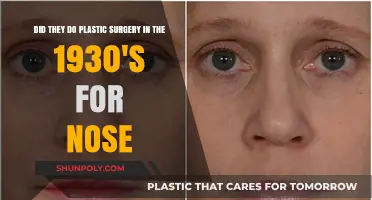 1930s Nose Jobs: The Surprising History of Early Rhinoplasty