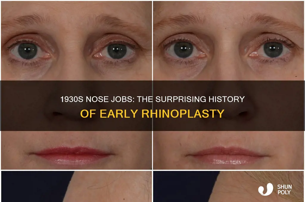 did they do plastic surgery in the 1930