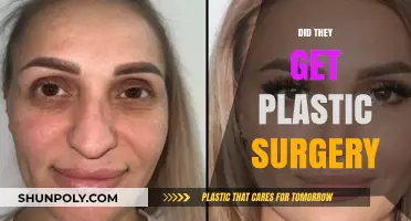 Plastic Surgery Speculations: Unveiling the Truth Behind the Transformation