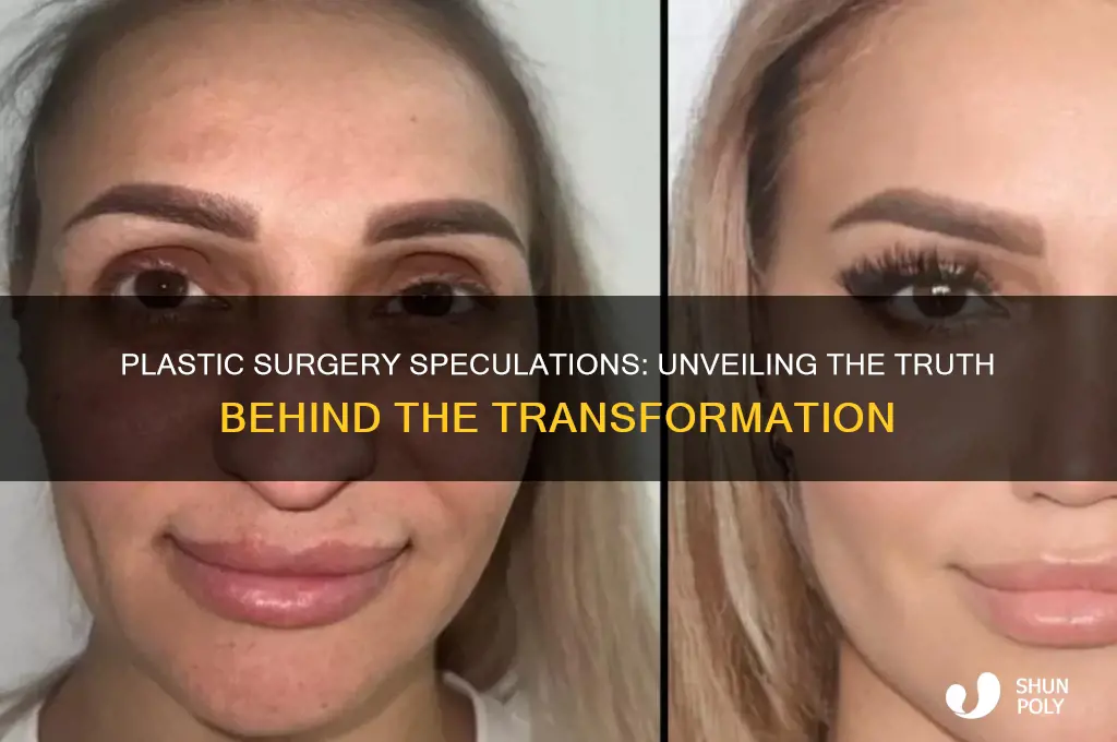 did they get plastic surgery