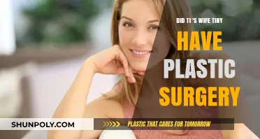 Tiny's Transformation: Did T.I.'s Wife Undergo Plastic Surgery?