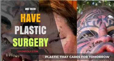 Tiger's Transformation: Uncovering the Truth About Plastic Surgery Rumors