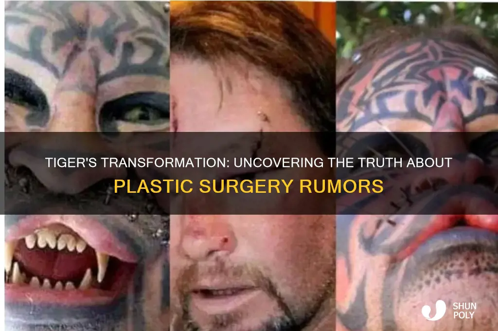 did tiger have plastic surgery
