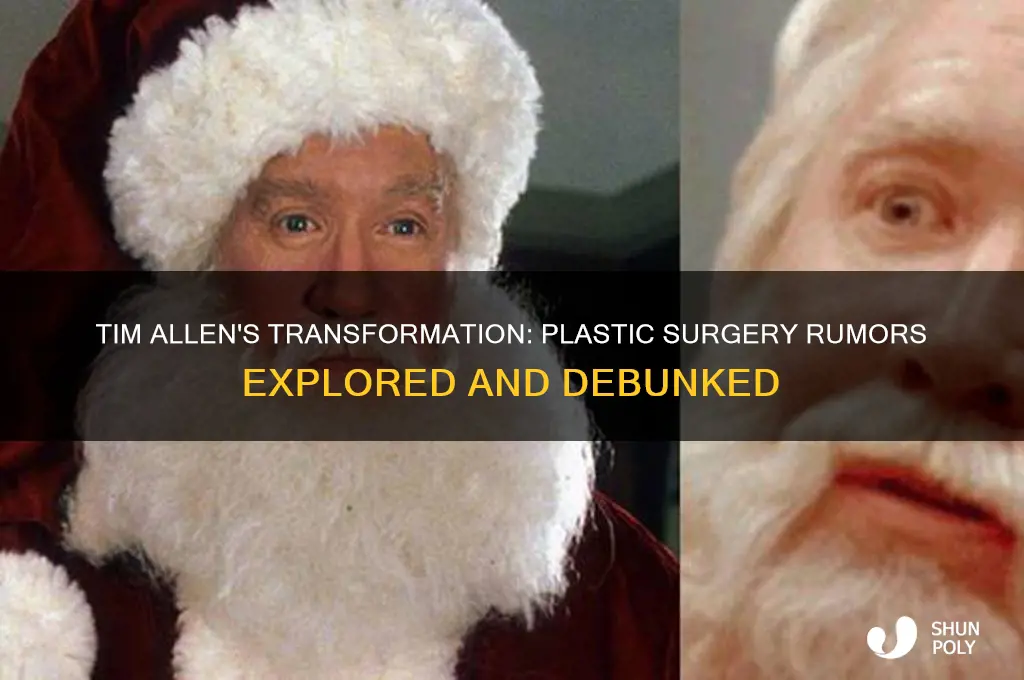did tim allen have plastic surgery