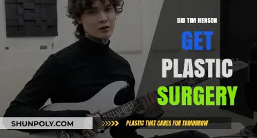 Tim Henson Plastic Surgery: Fact or Fiction? Uncovering the Truth
