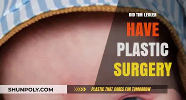 Tim Legler Plastic Surgery: Fact-Checking the Rumors and Speculations