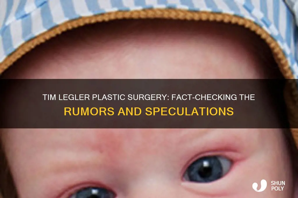 did tim legler have plastic surgery