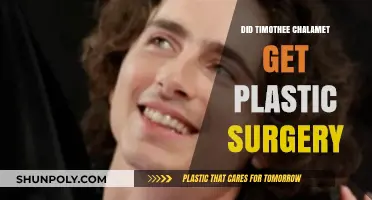 Timothée Chalamet's Transformation: Plastic Surgery Rumors Explored
