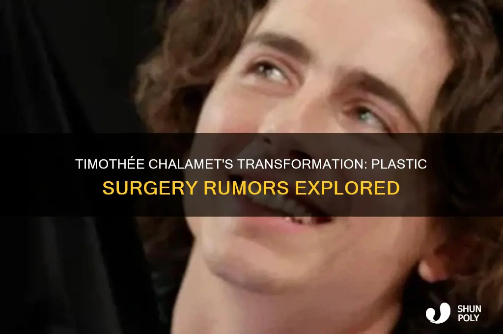 did timothee chalamet get plastic surgery