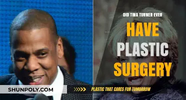 Tina Turner's Transformation: Plastic Surgery Rumors Explored