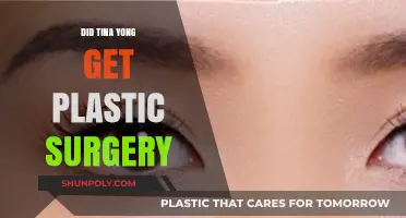 Did Tina Yong Undergo Plastic Surgery? Unveiling the Truth