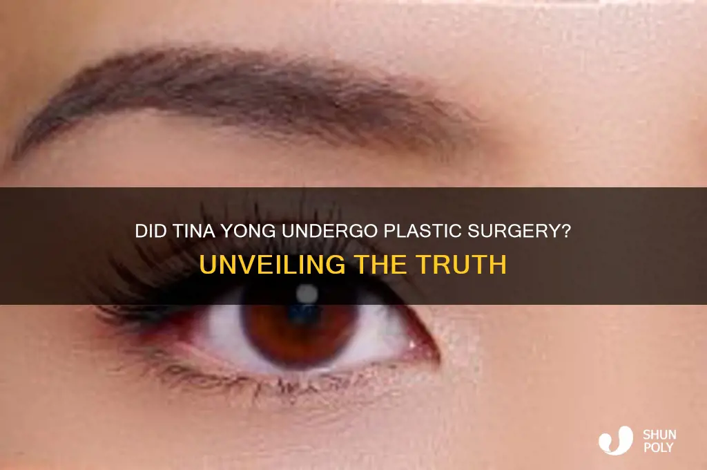 did tina yong get plastic surgery