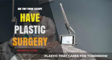 Did Tiny from Xscape Undergo Plastic Surgery? Unveiling the Truth