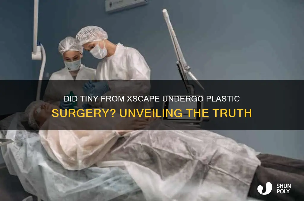 did tiny from xscape have plastic surgery