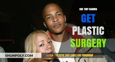 Tiny Harris Plastic Surgery: Fact-Checking Her Transformation Rumors
