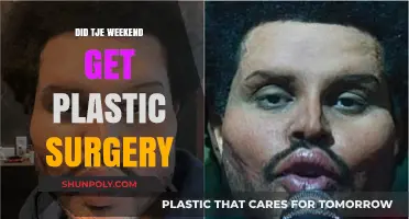 Did TJE Weekend Undergo Plastic Surgery? Unraveling the Truth