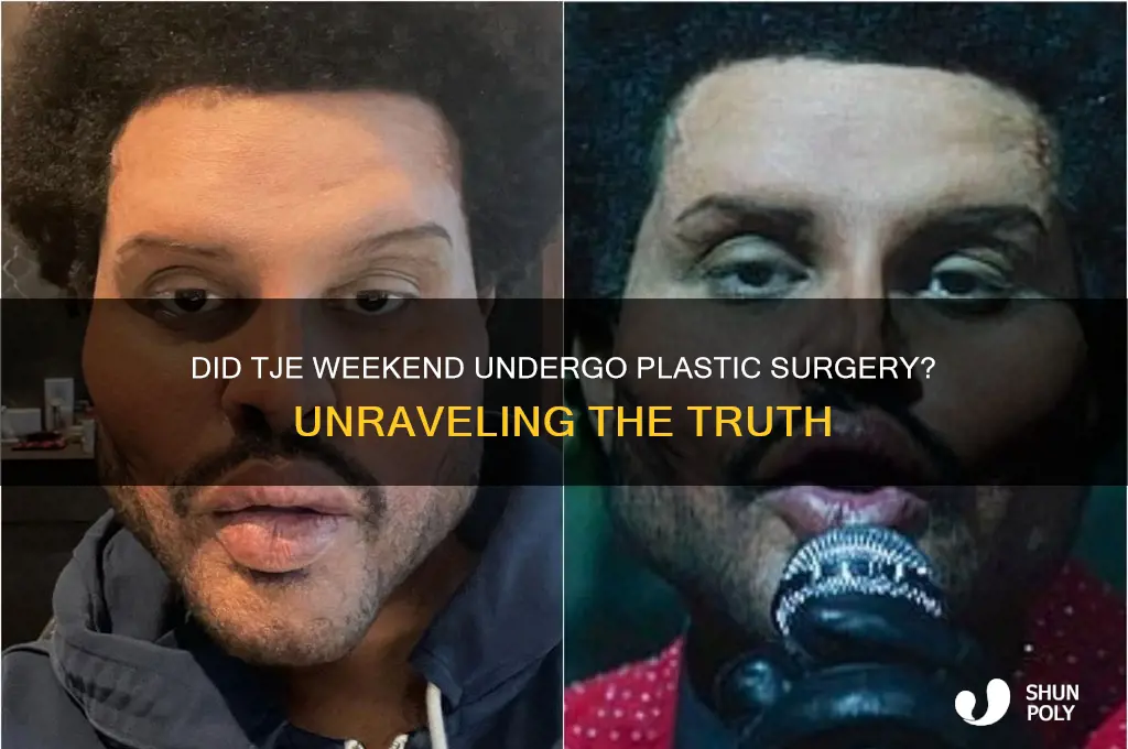 did tje weekend get plastic surgery