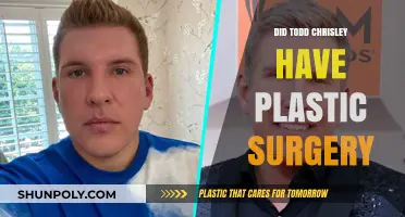 Todd Chrisley's Transformation: Plastic Surgery Rumors Explored and Debunked
