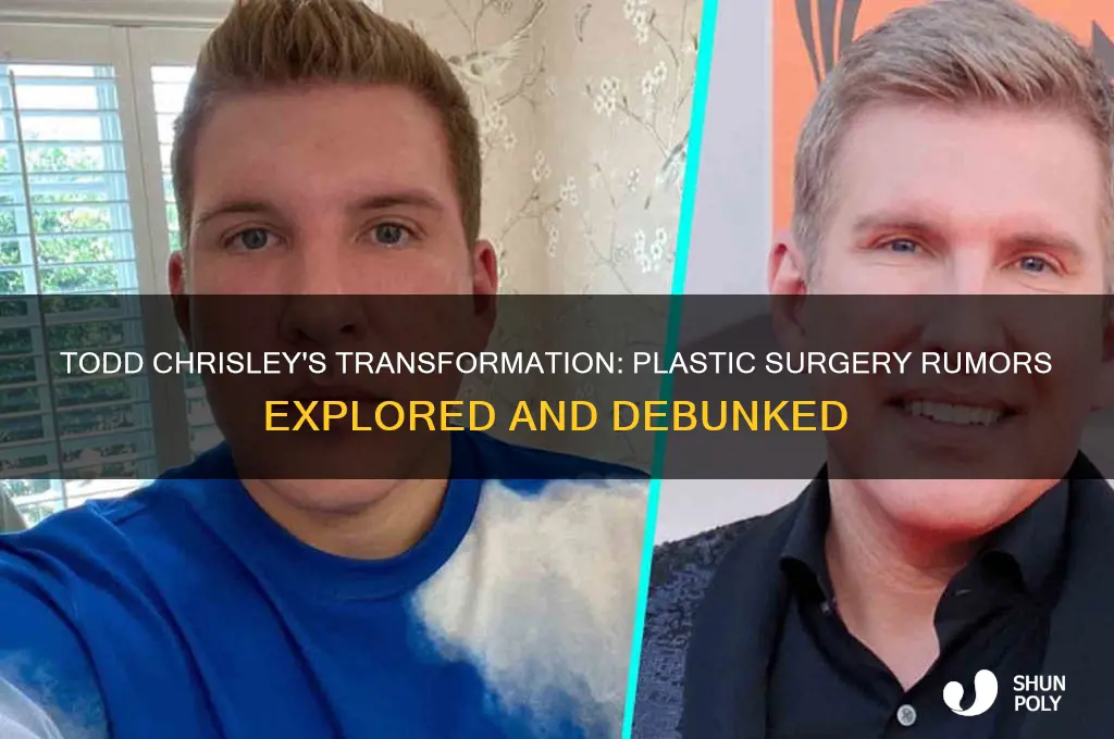 did todd chrisley have plastic surgery