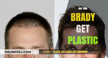 Tom Brady's Transformation: Plastic Surgery Speculations and Facts Revealed