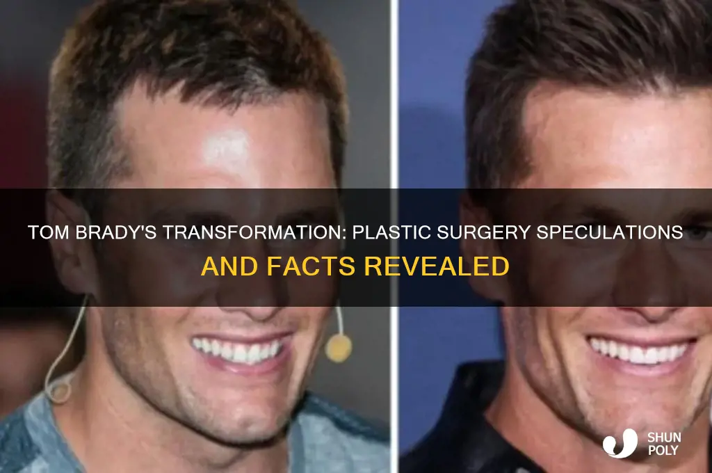 did tom brady get plastic