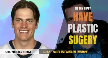 Tom Brady's Alleged Plastic Surgery: What's the Truth?