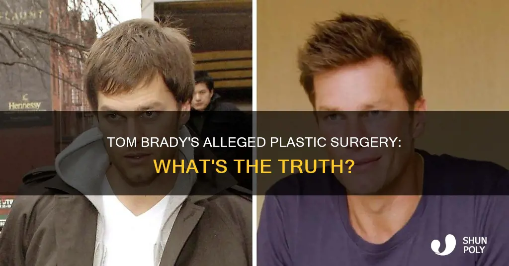 did tom brady have plastic sugery