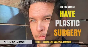 Tom Brooks' Transformation: Plastic Surgery Rumors Explored and Debunked