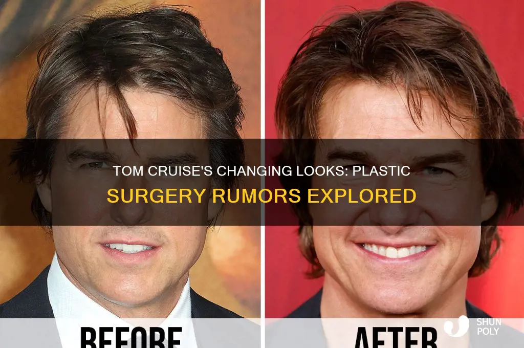did tom cruise do plastic surgery