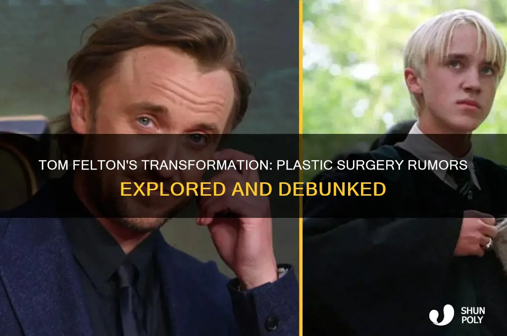 did tom felton get plastic surgery