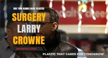 Tom Hanks' Transformation: Plastic Surgery Rumors in Larry Crowne