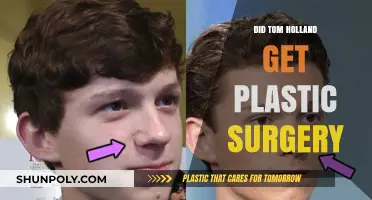 Tom Holland Plastic Surgery Rumors: Fact or Fiction?
