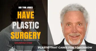 Tom Jones Plastic Surgery: Fact-Checking the Rumors and Speculations