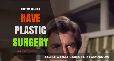 Tom Selleck's Appearance: Plastic Surgery Rumors Explored and Debunked
