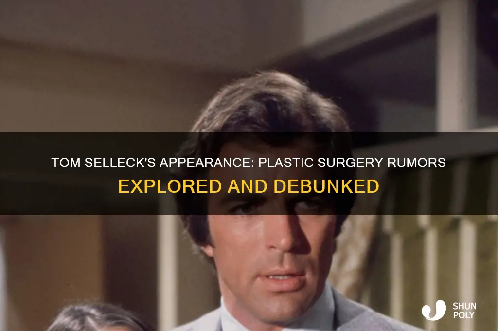 did tom selleck have plastic surgery