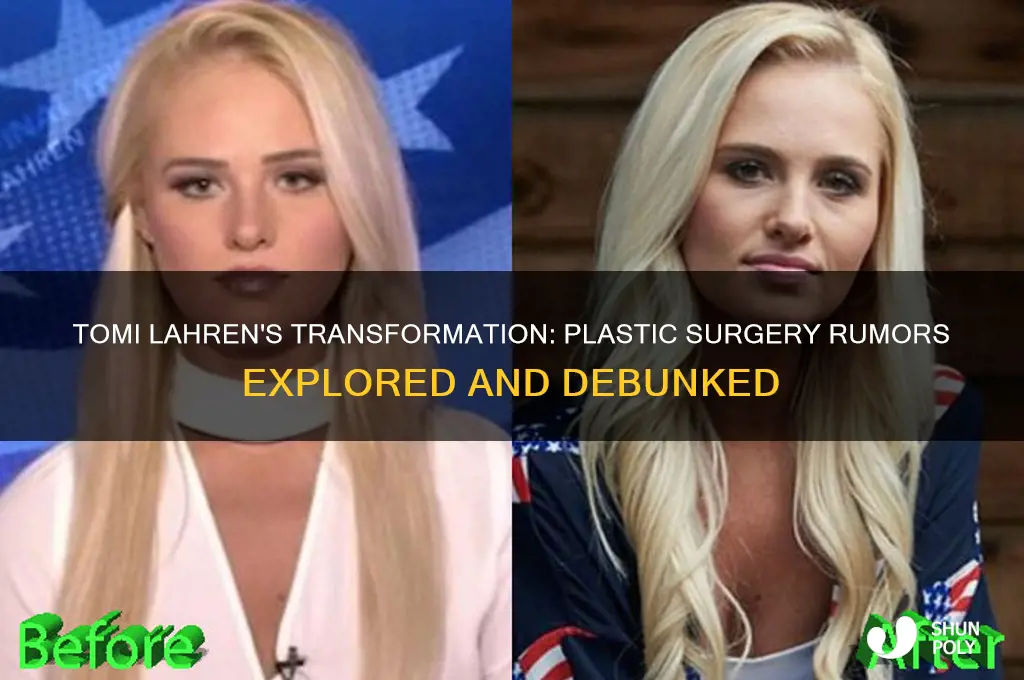 did tomi lahren get plastic surgery
